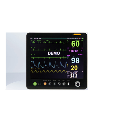 مانیتور EKG پزشکی علائم حیاتی مانیتور بیمار قابل حمل برای کلینیک بیمارستان
