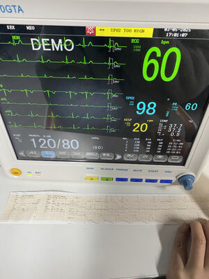 مانیتور بستر قابل حمل با EKG SPO2 NIBP TEMP RESP اختیاری ETCO2- کلاس II تضمین یک ساله